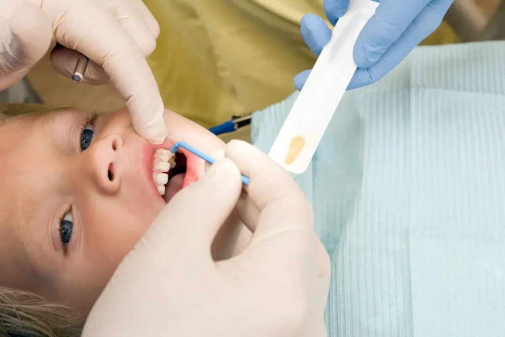 fluoride treatment in oceanside ny