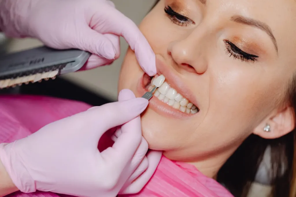 porcelain veneers in oceanside ny